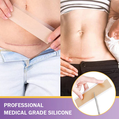 ✅Official Store | Hyaluronic Acid Nano Microneedle Repair Tape🏥(Treatment of old and new scars, reduction of surgical scars, stretch marks, keloids, acne, burns, warts, dermatomes and varicose veins)