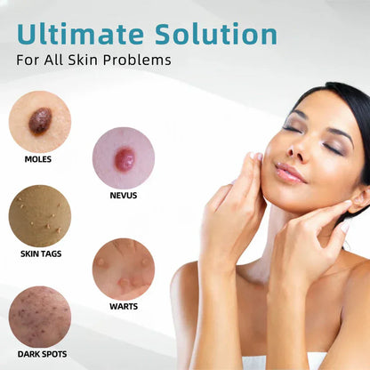 BLACK FRIDAY 70% OFF-Zynkoro VelvetSkin+Series ⚔️All-in-One Laser Eraser Pen🖊️ (🔬Powered by CO₂ laser technology – effectively removes moles, warts, skin tags, pigmentation spots, and other skin imperfections)