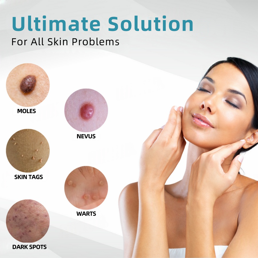 Medical-Grade Laser Pen 💕 (Powered by CO₂ laser technology – effectively removes moles, warts, skin tags, pigmentation spots, and other skin imperfections)🏆