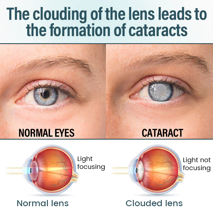 Fivfivgo® OptiFusion Nano Eye Drops Serum