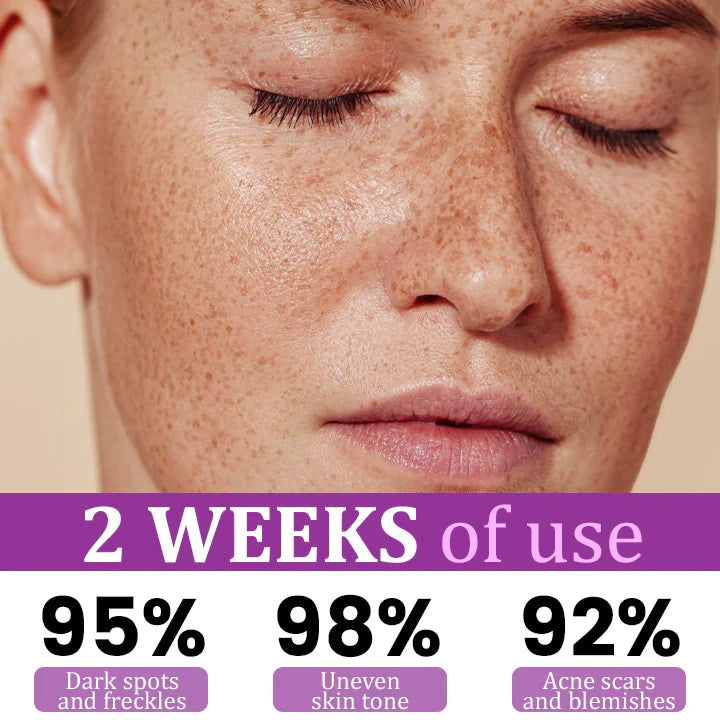 💧MelantraX Advanced Anti-Hyperpigmentation Essence