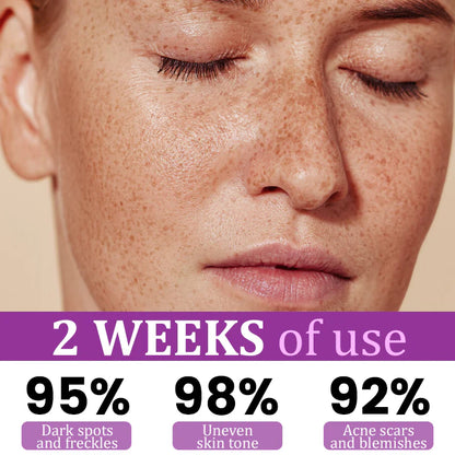 💧MelantraX Advanced Anti-Hyperpigmentation Essence