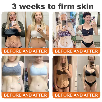 Made and Shipped from USA✨ BBOJI® Botulinum Toxin BEE VENOM Firming Serum Stick(🔥LAST DAY 70% OFF)💄