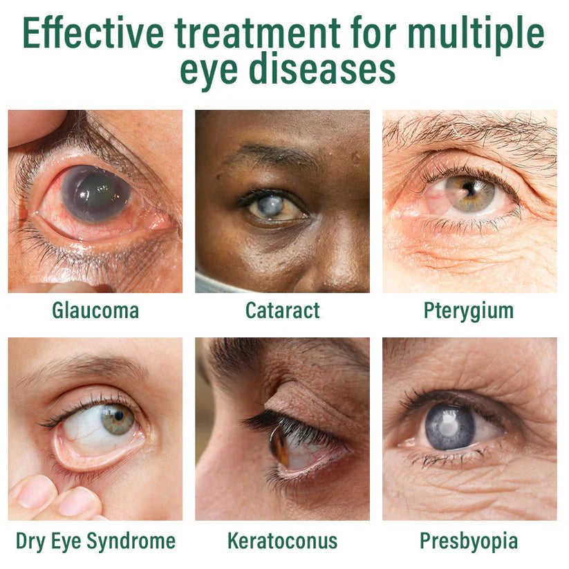 👩‍⚕️LOVILDS™ Nano Eye Drops Serum