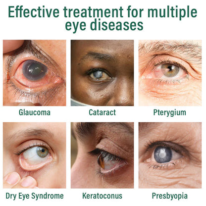 👩‍⚕️LOVILDS™ Nano Eye Drops Serum