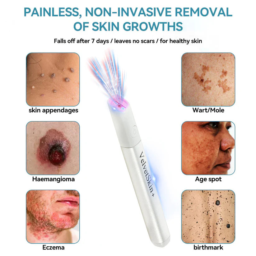 BLACK FRIDAY 70% OFF-Zynkoro VelvetSkin+Series ⚔️All-in-One Laser Eraser Pen🖊️ (🔬Powered by CO₂ laser technology – effectively removes moles, warts, skin tags, pigmentation spots, and other skin imperfections)