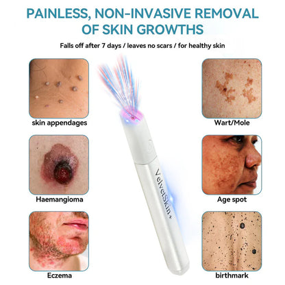 BLACK FRIDAY 70% OFF-Zynkoro VelvetSkin+Series ⚔️All-in-One Laser Eraser Pen🖊️ (🔬Powered by CO₂ laser technology – effectively removes moles, warts, skin tags, pigmentation spots, and other skin imperfections)