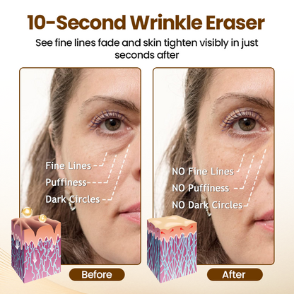Oveallgo® Liftora 10s Wrinkle Serum