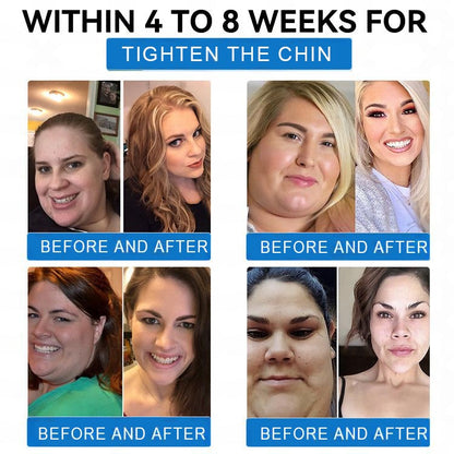 🎉Last Day 80% OFF🎉 ZVOEVO® SMGT-GLP-1 Tirzepatide & Collagen Nano Microneedle Weight Loss Patch | Targets Obesity, Loose Skin, High Blood Pressure, Diabetes, Fatty Liver, Joint Pain, Brain Fog, Low Energy, Body Aches, and More