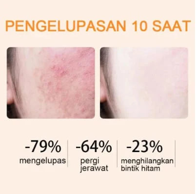 🍊Orange Enzyme Exfoliating Gel — The Gentle Miracle Your Skin Has Been Crying Out For