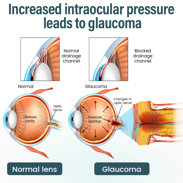 Timilk® OptiFusion Nano Eye Drops Serum