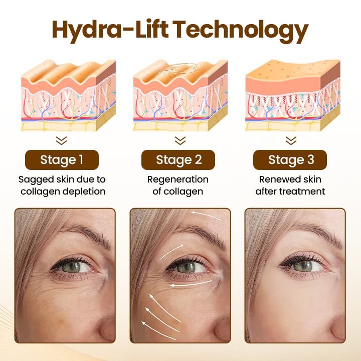 Oveallgo® Liftora 10s Wrinkle Serum