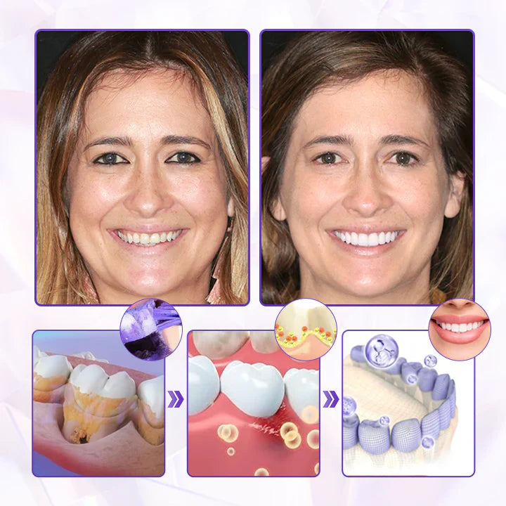 Oveallgo® BeeRenew Advanced Gum Healing Toothpaste