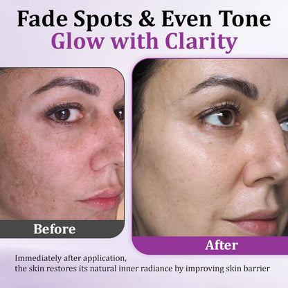 💧MelantraX Advanced Anti-Hyperpigmentation Essence