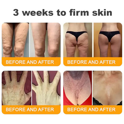 𝐋𝐎𝐕𝐈𝐋𝐃𝐒™ 𝐁𝐞𝐞 𝐕𝐞𝐧𝐨𝐦 𝐀𝐥𝐥-𝐢𝐧-𝐎𝐧𝐞 𝐂𝐫𝐞𝐚𝐦–🌸 Anti-aging,Hydrating, Skin Repair, Even Tone, Acne and Dark Spot Treatment, Wart and Mole Removal, Psoriasis Relief