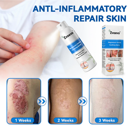 ✅ Official Store: Magnesium Herbal Psoriasis Spray⚕️FDA Approved (Relieves psoriasis and eczema, treats rosacea and acne, alleviates psoriatic arthritis)