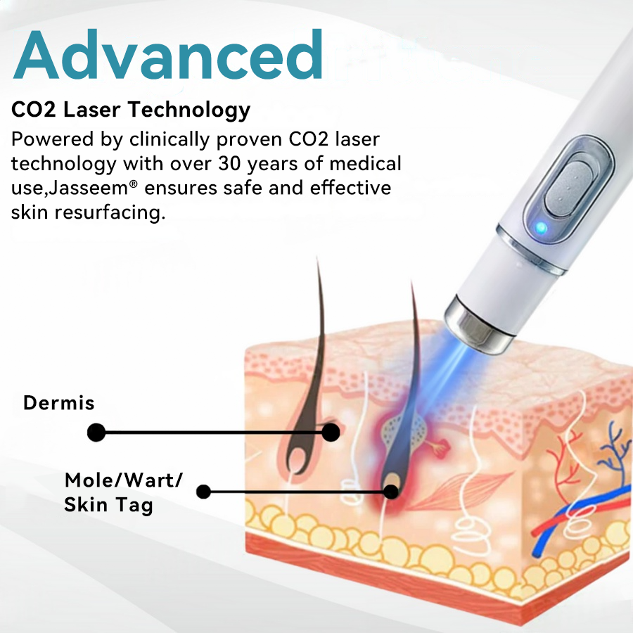 Medical-Grade Laser Pen 💕 (Powered by CO₂ laser technology – effectively removes moles, warts, skin tags, pigmentation spots, and other skin imperfections)🏆