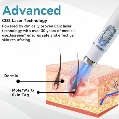 Medical-Grade Laser Pen 💕 (Powered by CO₂ laser technology – effectively removes moles, warts, skin tags, pigmentation spots, and other skin imperfections)🏆