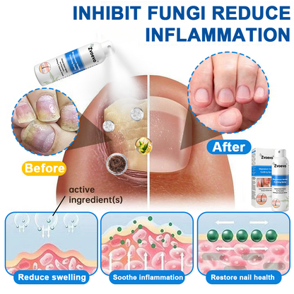 ✅ Official Store: Magnesium Herbal Psoriasis Spray⚕️FDA Approved (Relieves psoriasis and eczema, treats rosacea and acne, alleviates psoriatic arthritis)